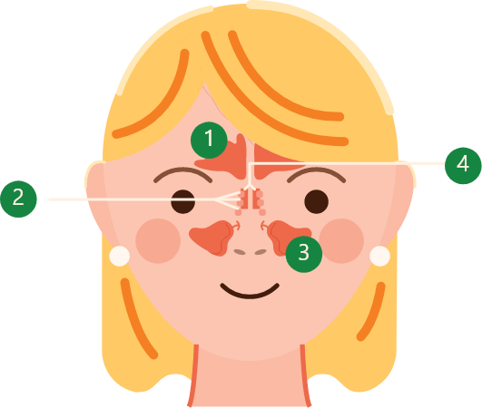 Diagram showing the 4 types of sinuses